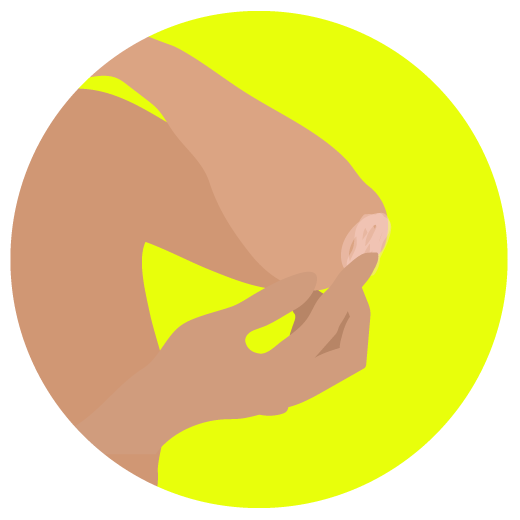 Illustration on person applying Wonderwild Miracle Butter on elbow.