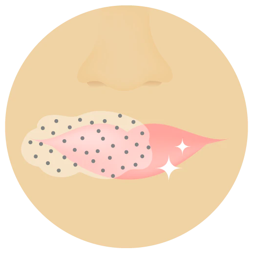 Illustration of the the nose and lips area with Slaai Make Up Melting Butter Cleanser and Boo Booster applied to lips.