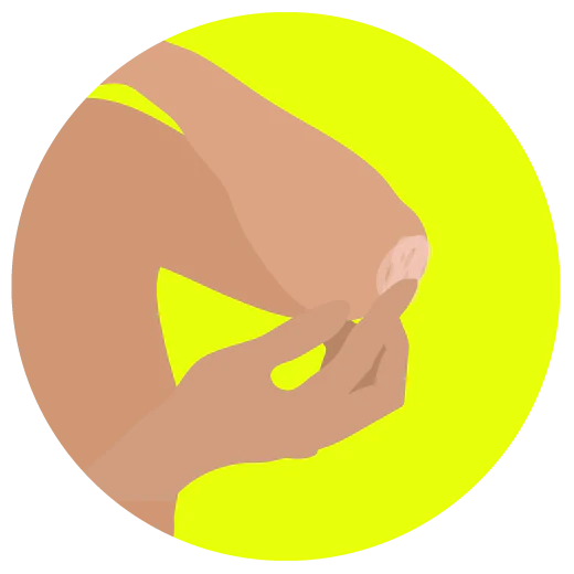 Illustration d'une personne touchant un coude sec et squameux