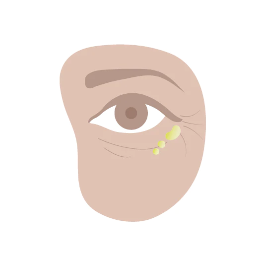Illustration de la zone autour des yeux et des joues avec quelques gouttes d’huile Marula vierge sous les yeux pour aider à minimiser les lignes fines et rajeunir la peau.
