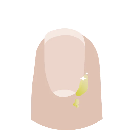 Illustration d’un ongle d’un doigt avec quelques goutres d’huile Marula vierge sur la cuticule pour l’adoucir et l’hydrater.